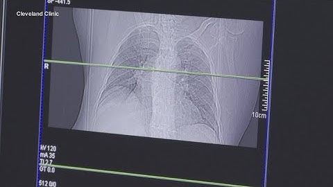 US Surgeon General issues new warning about lung cancer