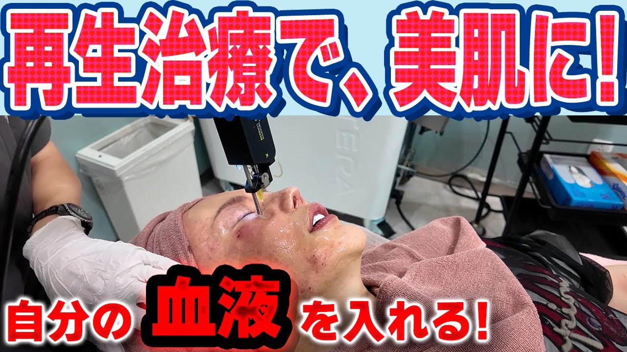 【再生医療】自分の血液を使って、美肌に！