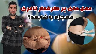 عمل‌های جراحی لاغری: راه آخر برای کاهش وزن سریع | مزایا و معایب