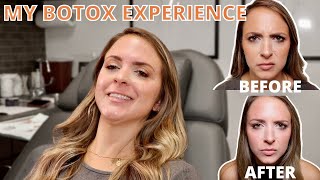 COME GET BOTOX WITH ME!| Entire Botox Process and 2 Week Results #RadianceMedSpaATL