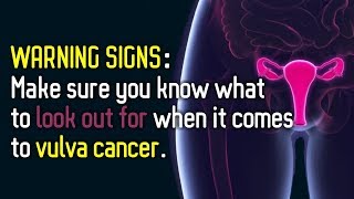 WARNING SIGNS Make sure you know what to look out for when it comes to vulva cancer by Medical.Animation.Videos.Library 5,984 views 6 years ago 2 minutes, 25 seconds