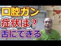 舌にできる口腔がんの症状とは？【千葉市中央区の歯医者】