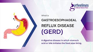 All About GERD, gastroesophageal reflux disease Causes Symptoms Treatment Dr Bharat Kumar Nara gerd