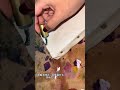 毒の量が似てるって大切だよね