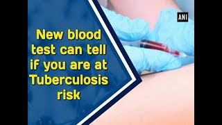 New blood test can tell if you are at Tuberculosis risk - Health News