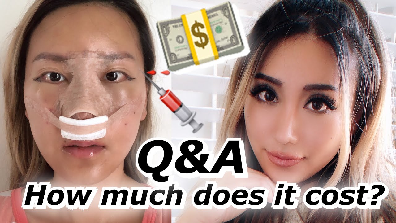 ⁣Plastic Surgery Q&A | How much it costs, pain, healing time