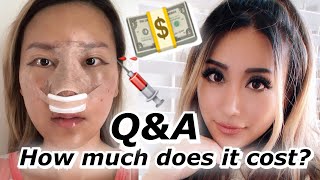 Plastic Surgery Q&A | How much it costs, pain, healing time