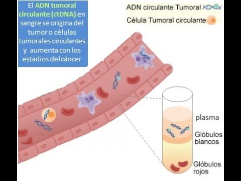 Vídeo: Utilidad Del ADN Tumoral Circulante En El Diagnóstico Del Cáncer Con énfasis En La Detección Temprana