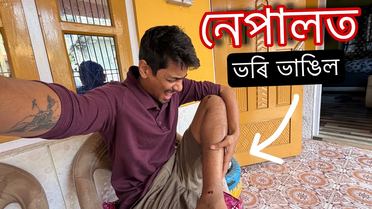 ভৰি ভাঙিল এ নেকি নেপাল ত - Got a serious leg injury in Nepal 