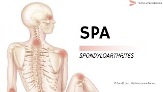 les spondyloarthrites : Spa. + qcm et cas clinique