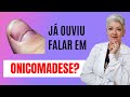 Já Ouviu Falar em ONICOMADESE?