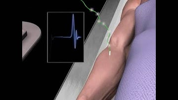 Electrodiagnostics animation