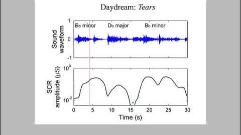 Music-induced transient suppression of skin conductance responses