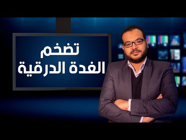 تضخم الغدة الدرقية - دكتور أسامة رفاعي محمد إستشاري الجراحة العامة والمناظير