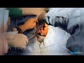 Hemorrhoidopexy Procedure Using Hemorrhoid Stapler | Minimally Invasive Treatment for Hemorrhoids |