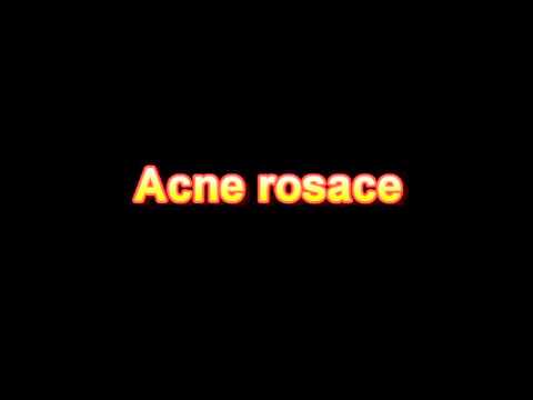 what is the definition of Acne rosacea (Medical Dictionary Online)