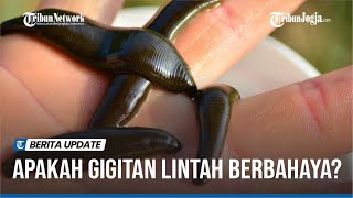 APAKAH GIGITAN LINTAH BERBAHAYA