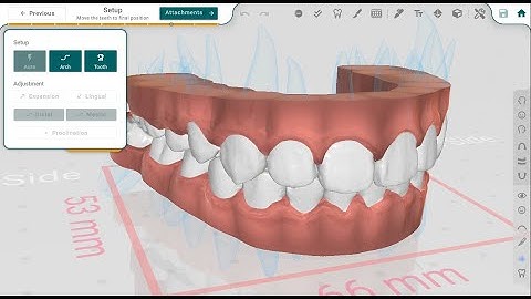 Quick Start Guide for Titan Dental Design