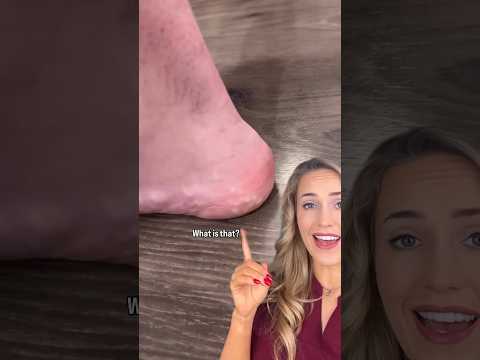 What Is That Heel Condition 