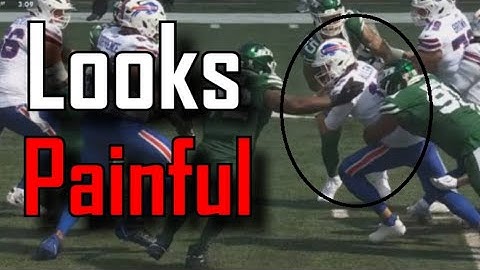 Josh Allen came away with a bloody nose after this tackle | Buffalo Bills Vs Miami Dolphins
