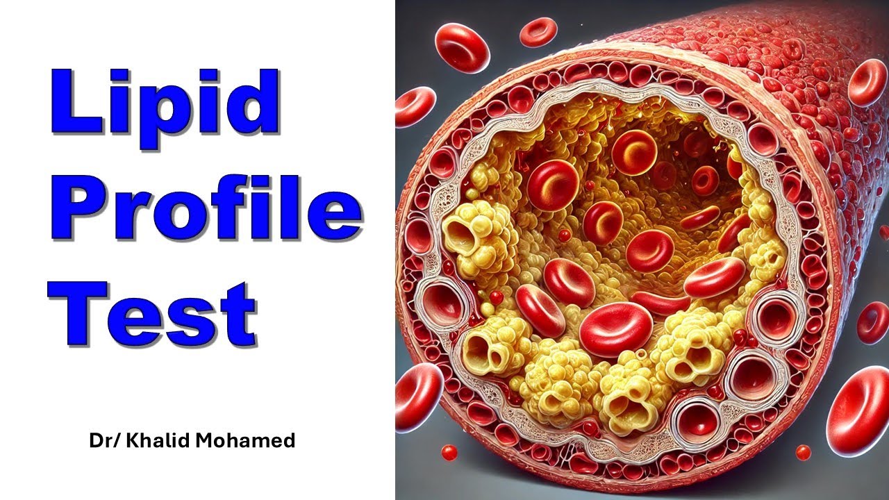 Lipid Profile Test. تحليل نسبة الدهون بالدم #explore #trending #شرح_بالعربي