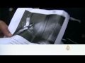 قتلى وجرحى في اشتباكات وتفجير