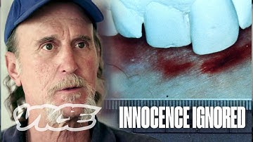 Forensic Science Put Me on Death Row for My Teeth | Innocence Ignored