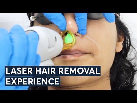 Is laser hair removal worth it?