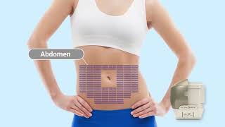 Ultraformer Iii Get Your Perfect Abdomen
