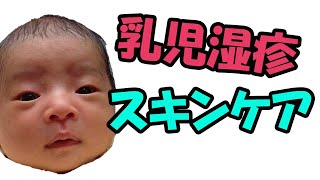 乳児湿疹・スキンケアの基本【助産師MAYO#111】