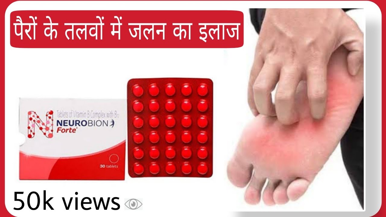 Burning Feet Treatment in Hindi । पैरों में जलन का इलाज YouTube