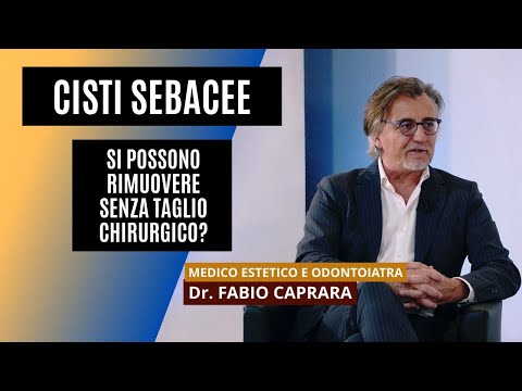 Video: Quale dottore rimuove le cisti?