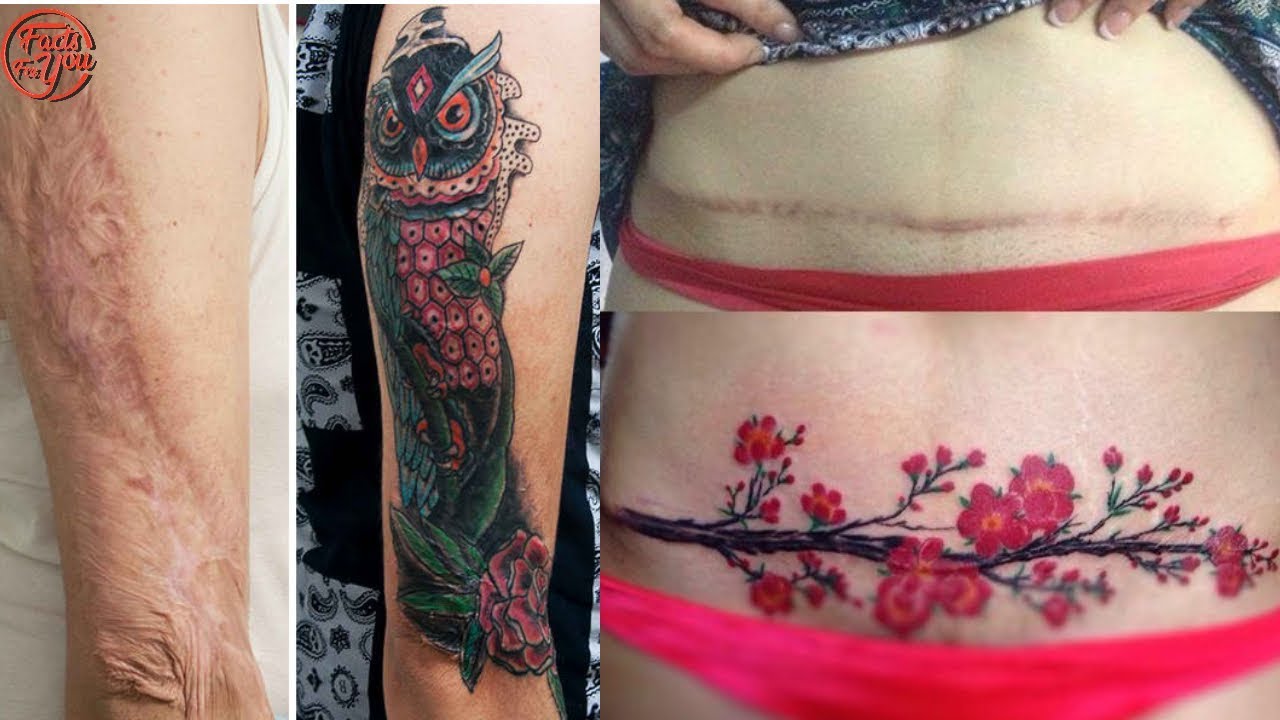 Tummy tuck scar coverup tatt  Bauch tattoos Heiße tattoos  Bauchdeckenstraffung tattoo