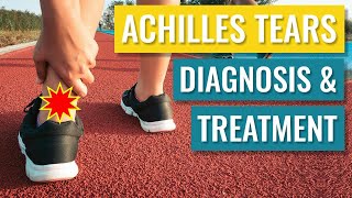 Achilles Tendon Tears - Diagnosis and Treatment of Complete Ruptures