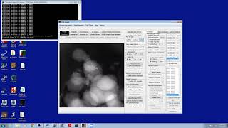 Celebrity Tomography manual alignment (1of3) Net Worth