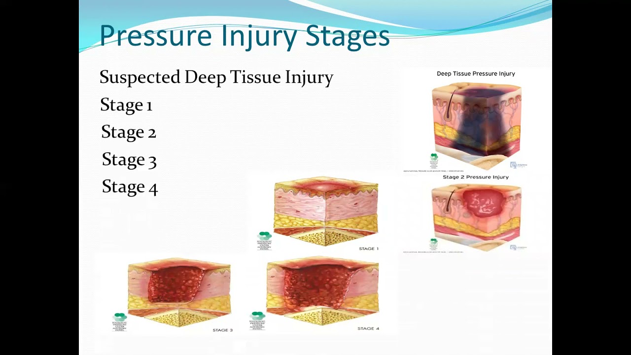 Pressure Injuries