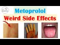 Metoprolol (&amp; Beta Blockers) Weird Side Effects (Skin, Gastrointestinal, Psychological)
