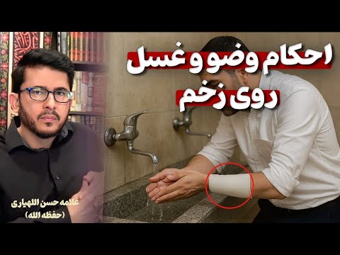 احکام وضو و غسل روی زخم    