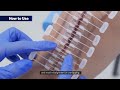 How to Use Klosure Non-invasive Skin Closure
