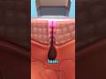 Science behind laser hair remove #laserhairremoval #skincare #beautycare