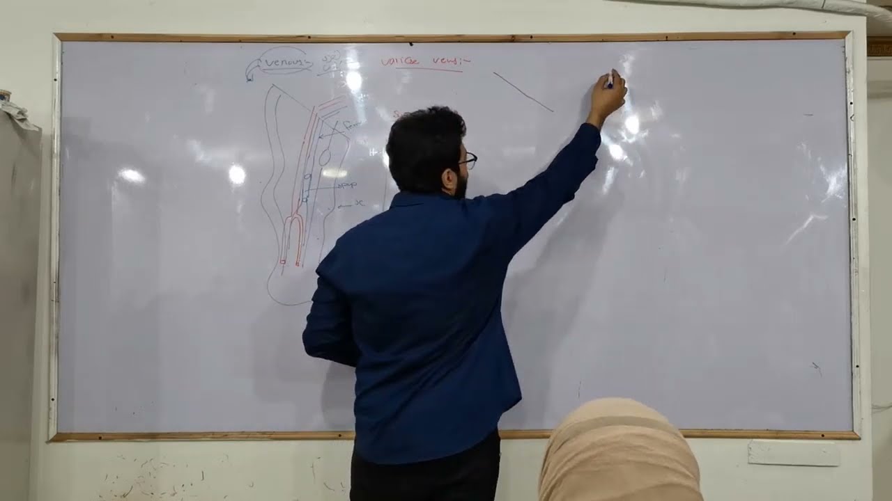 Vascular Surgery: Venous Part 1