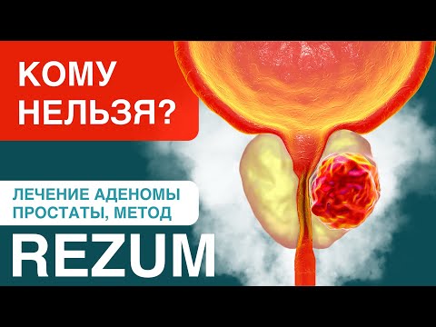 Основные противопоказания лечения аденомы простаты методом Rezum-терапии