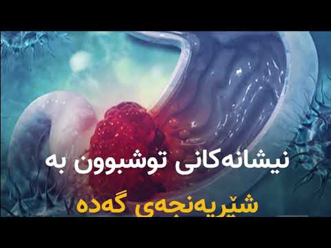 نیشانەکانی توشبوون بە شێرپەنجەی گەدە