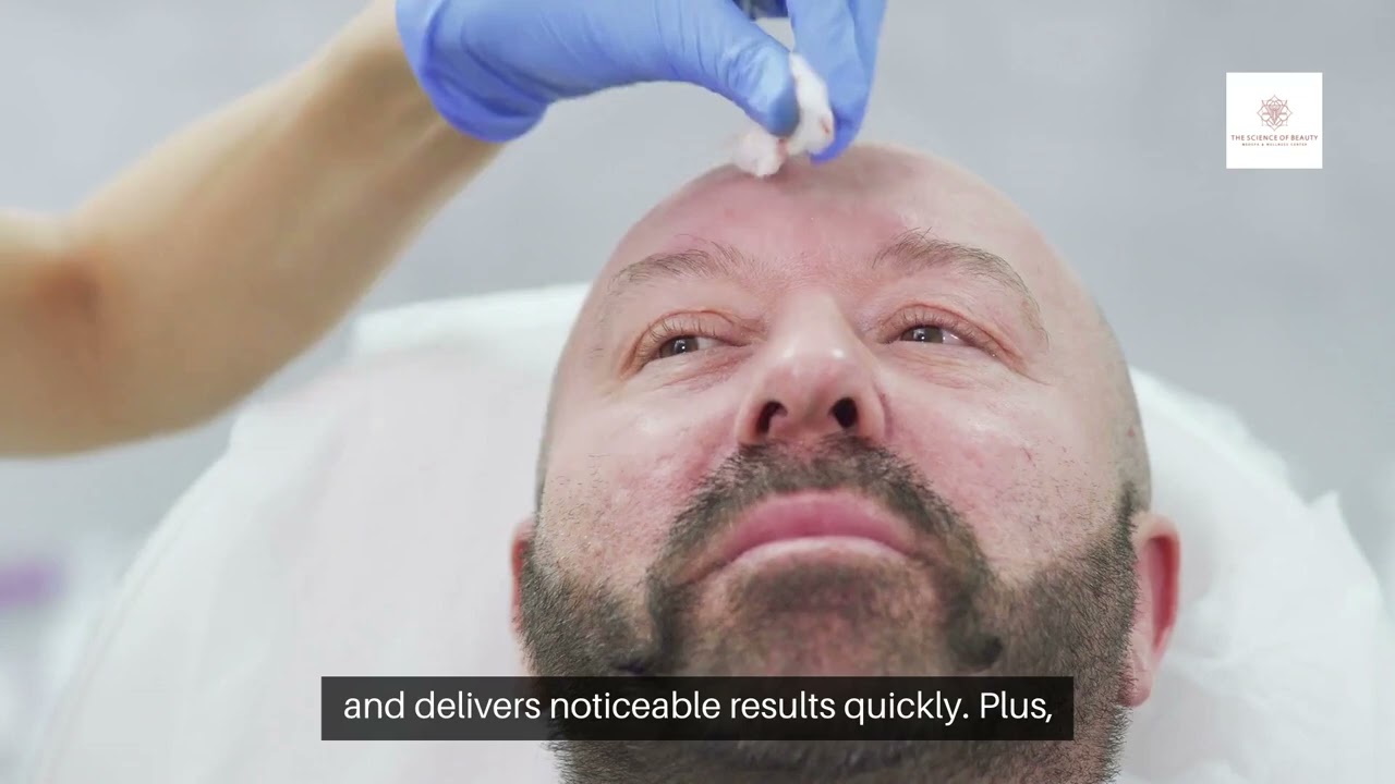 Best Botox Injections in Dallas, TX – What You Need to Know!