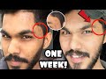 Remove DARK SPOTS |Black Spots In 1 Week |Skin Care Tips For Men|NishadNisham