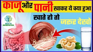 रोज सुबह काजू खाने के फायदे इतने मिलेंगे कि आपने सोचे ना होंगे | Benefits of Cashew in Hindi