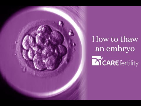 Video: Dicot embryo txawv ntawm monocot embryo li cas?