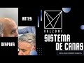 Sistema capilar con cana