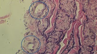 Vaso vasorum | histo slide