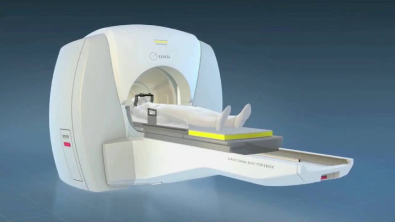 Gamma Knife, neuroradiocirugía cerebral sin bisturí en Hospital San
